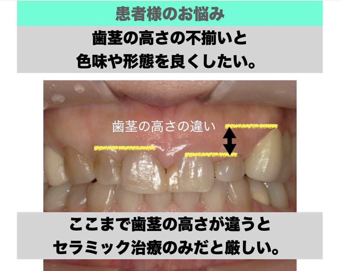 患者様のお悩み