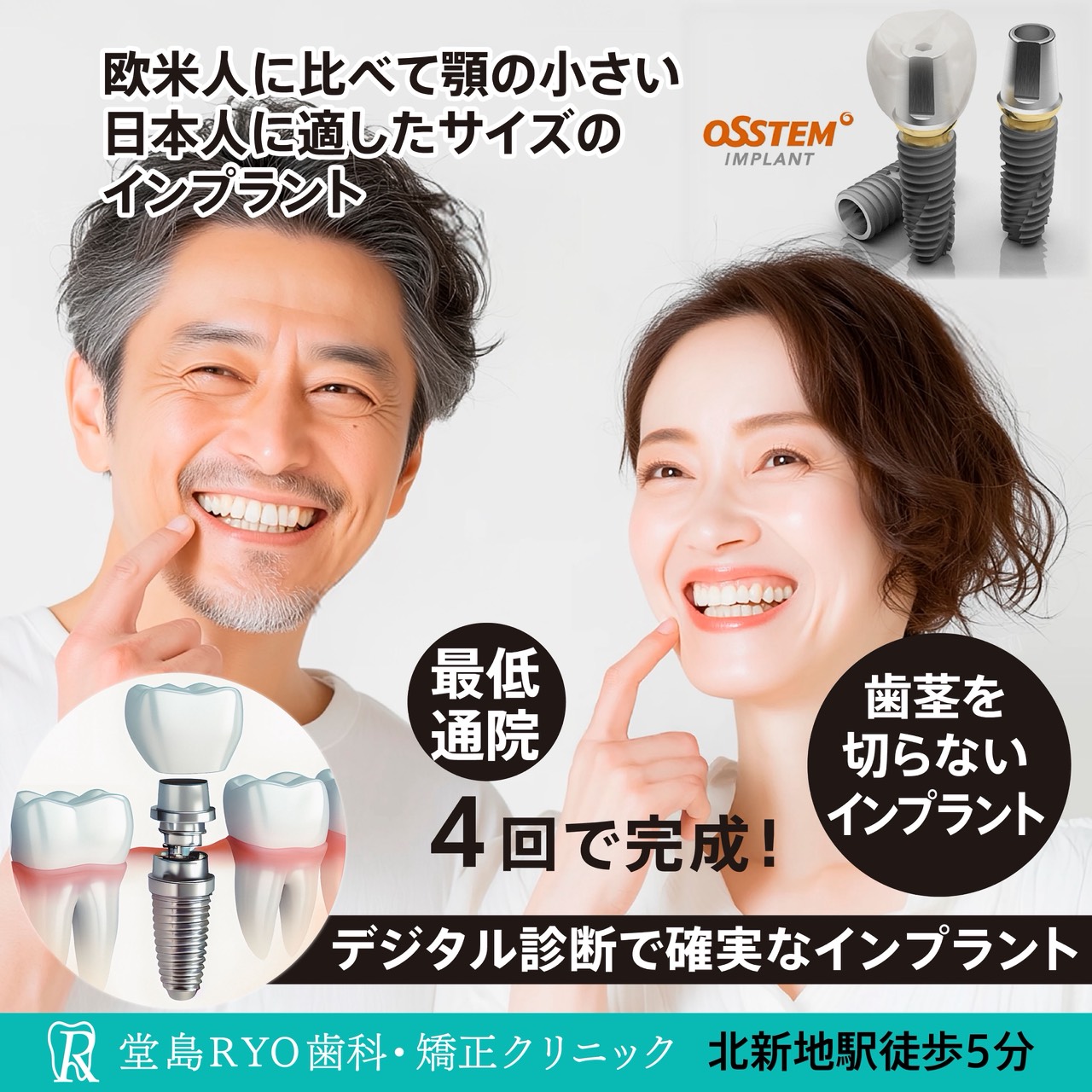 デジタル診断で確実なインプラント