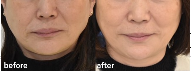 笑顔で話せる毎日が、戻ってきた。