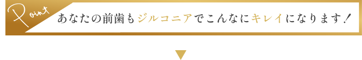 あなたの前歯もジルコニアでこんなにキレイになります！