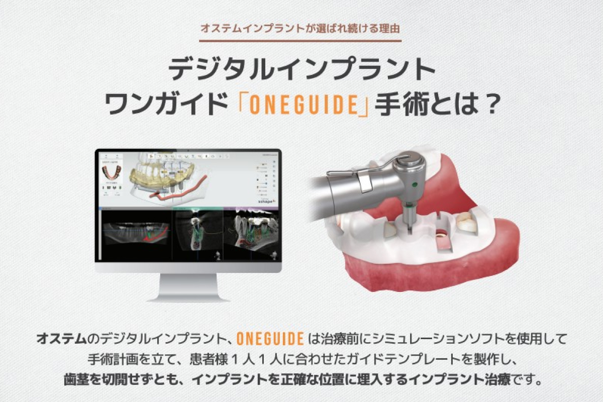 オステムインプラント