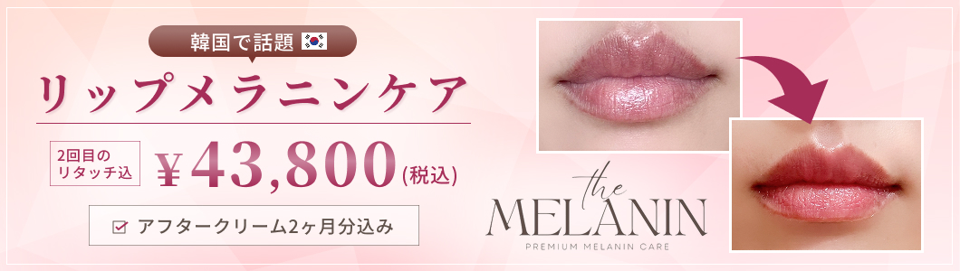 オープニングキャンペーン