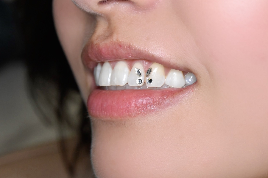 ティースジュエリーとは？