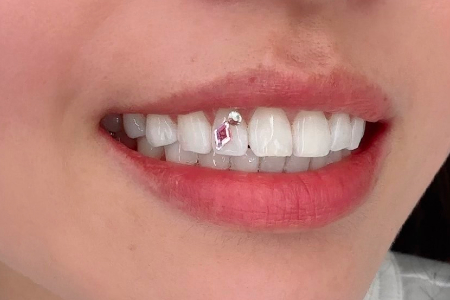 取り外しとメンテナンスについて