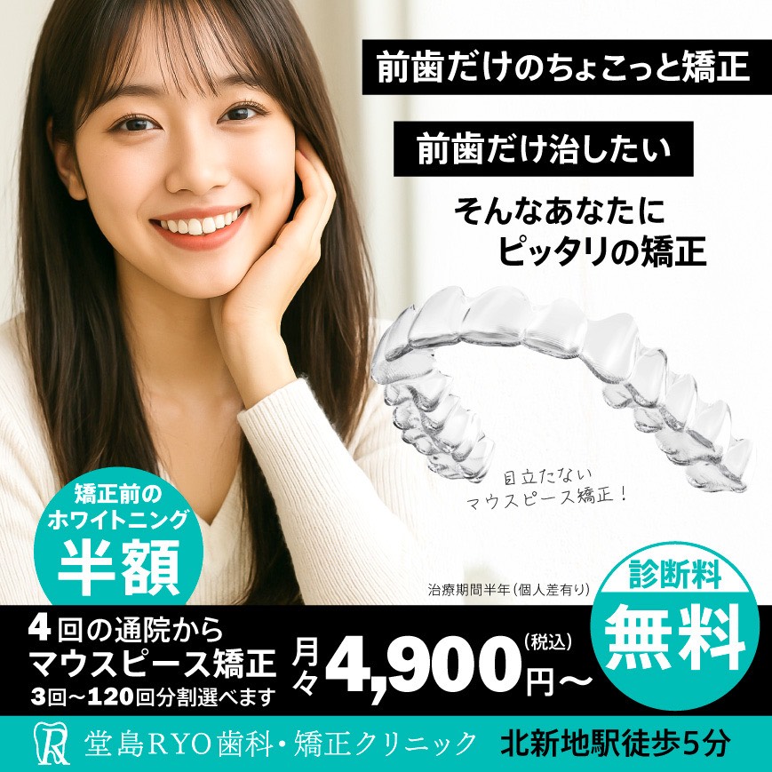 当院で出来る前歯だけのちょこっと矯正！