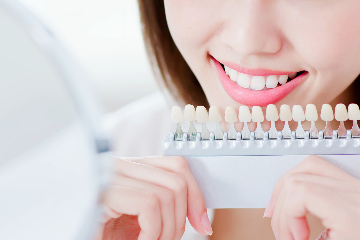 自宅で手軽に、白さが続くホームホワイトニング