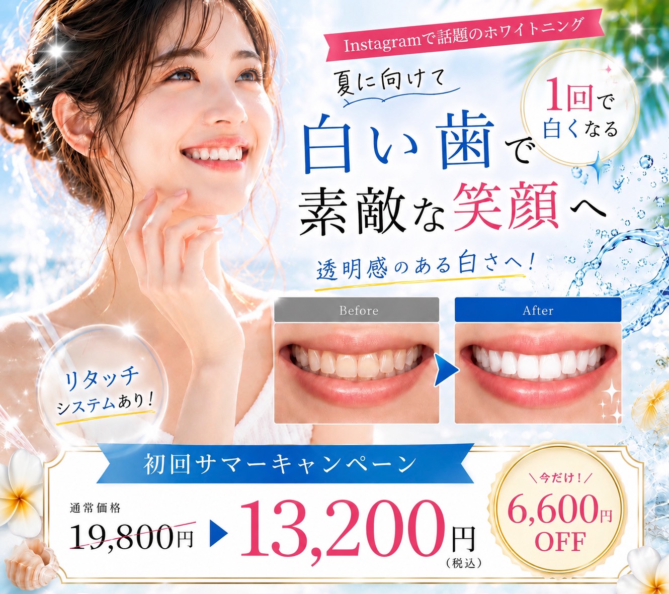ホワイトニングキャンペーン