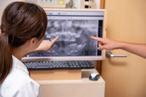 10年前のレントゲン中心のインプラント診断イメージ