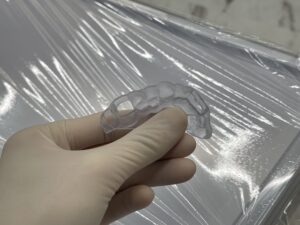 オステムワンガイドシステムを用いたインプラント手術