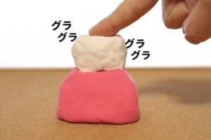 歯周病で歯茎がグラグラする様子
